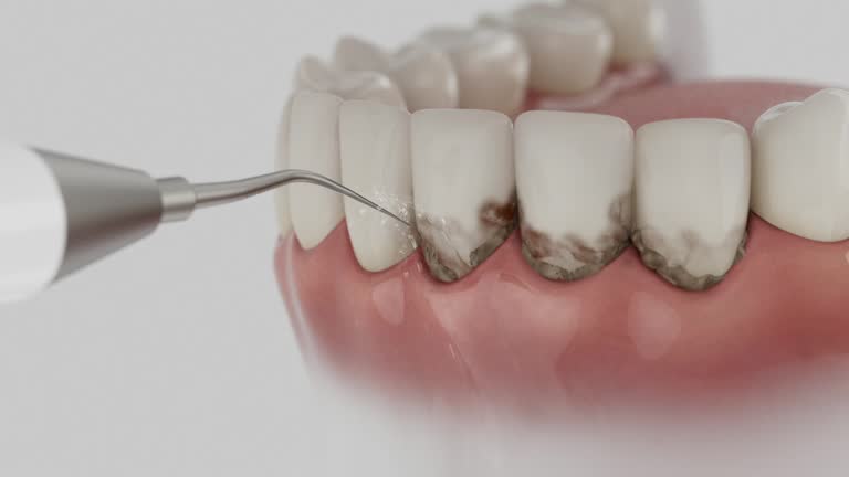 Reliable Teeth Cleaning And Checkup contractor in Crawford County County, GA by Dentist Open Now